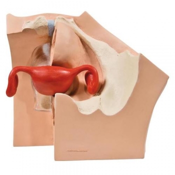 Gynäkologischer Trainer zur Patientenaufklärung