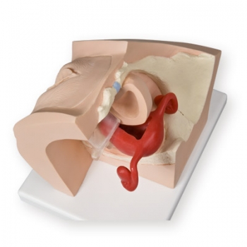 Gynäkologischer Trainer zur Patientenaufklärung