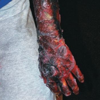 Moulage Movie - Moulage Film aud DVD