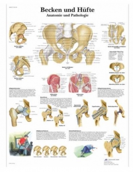 Lehrtafel - Becken und Hüfte - Anatomie und Pathologie
