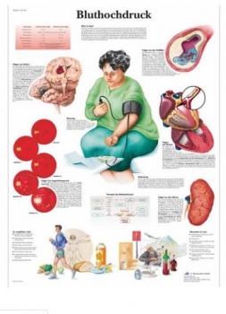 Lehrtafel - Bluthochdruck
