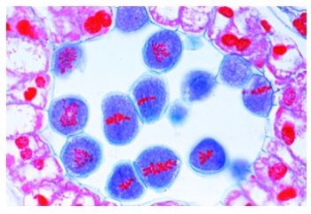 Mitose und Meiose Serie II