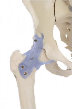 Skelett mit Bandapparat, Otto