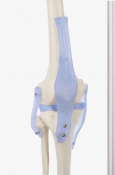 Skelett mit Bandapparat, Otto