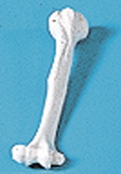 Humerus (Oberarm)
