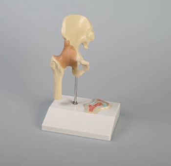Mini-Hüftgelenkmodell mit Querschnitt
