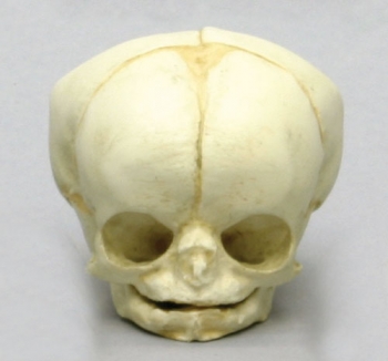 Fetusschädel, 35 Wochen