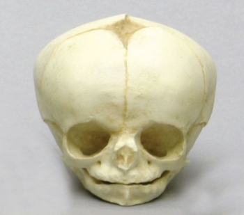 Fetusschädel, 34 Wochen