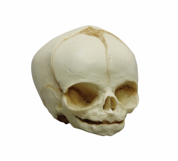 Fetusschädel, 31. Woche