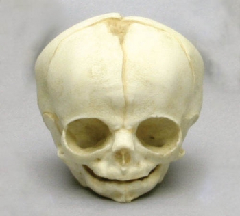 Fetusschädel, 30 Wochen