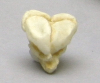 Fetusschädel, 13 Wochen