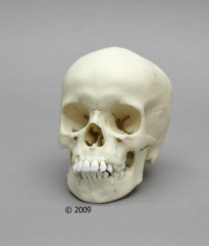 Kinderschädel, 9-jährig