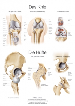 Lehrtafel Das Knie / Die Hüfte (AL551)