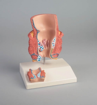 Hämorrhoidenmodell 2-fache Größe
