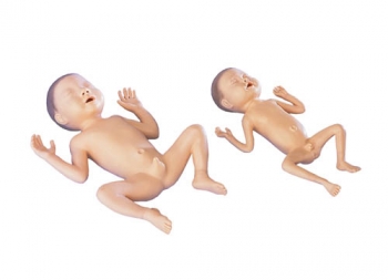 Frühgeborenen-Modell, 24 Wochen alter Junge