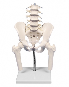 Lendenwirbelsäule mit Becken zur Fehlstellungsdemonstration