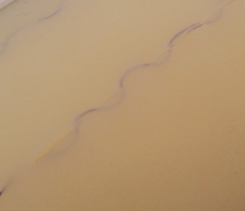 Transparentes Intrakutan-Hautnaht-Pad für 7060