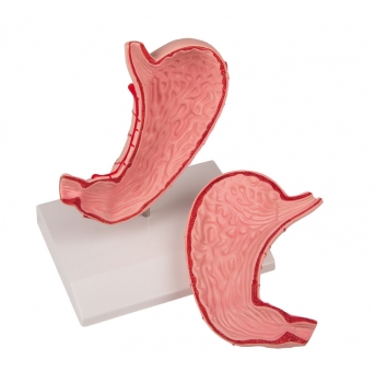 Magen, natürliche Größe, 2-teilig