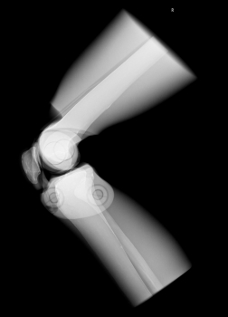 Röntgen-Teilphantom mit künstlichen Knochen - Rechtes Knie, transparent