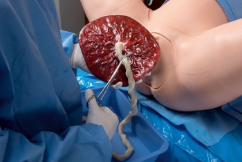 Geburtssimulator, Super OB Susie