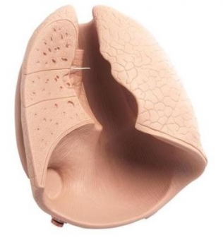 Ersatz Lunge für P10