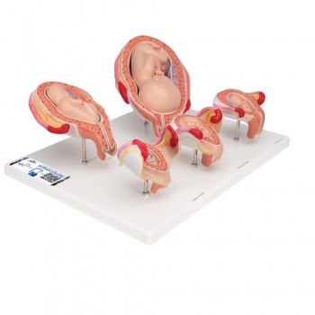Schwangerschaftsmodell Serie, 5 Modelle - 3B Smart Anatomy