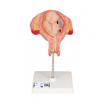 Fetus Modell, 5. Monat, Steißlage