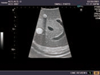 Ultraschall-Modell für Sonografie