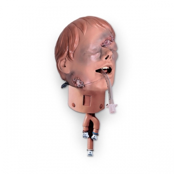 Intubationskopf mit Verletzungen