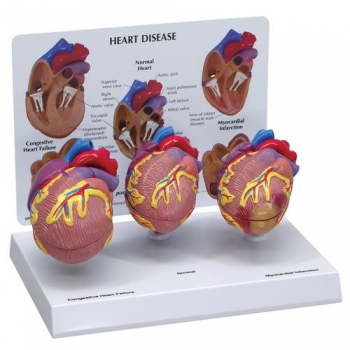 Herzmodell-Set, 3-Mini