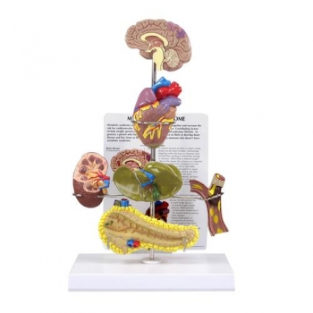 Modell eines metabolischen Syndroms