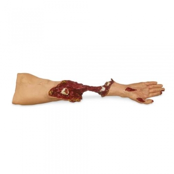 Xtreme Moulage-Verletzungsarm