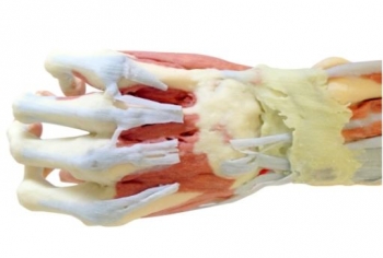 Tiefe Präparation der oberen Extremität und Hand