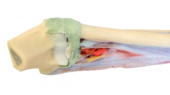 Unterarm und Hand, tiefe Präparation