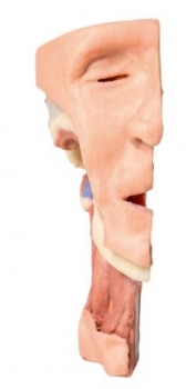 Tiefe Gesichtsknochen/Fossa infratemporalis