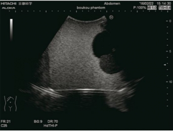 Übungsmodell Intravesikale Urinvolumenmessung