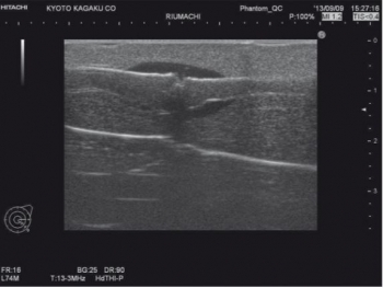 Rheumatisches Fingerphantom