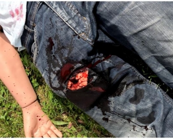 Schusswunden Trainer, Wound Packing Trainer