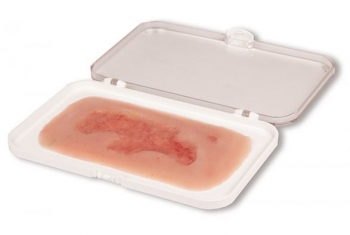 Wundmoulage Ulcus Cruris Venosum, klein, Epithelisierungsphase