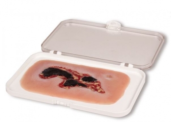 Wundmoulage Ulcus Cruris Arteriosum, klein, Exsudationsphase