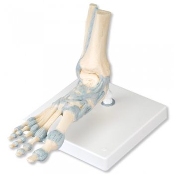 Modell des Fußskeletts mit Bändern