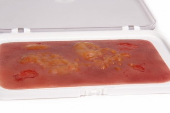 Wundmoulage Brandwunde 2. Grades