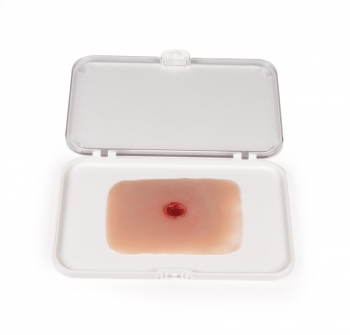 Wundmoulage Einschußwunde