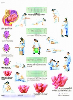 Lehrtafel - Die Geburt