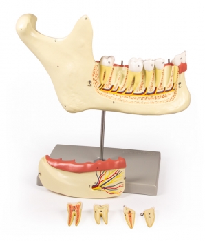 Unterkiefer, 6 Teile