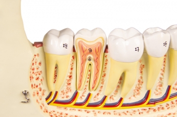 Unterkiefer, 6 Teile