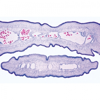 Parasitologie, Kurzserie, Einheimische und tropische Parasiten des Menschen und der Haustiere - Deutsch