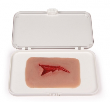 Wundmoulage Risswunde