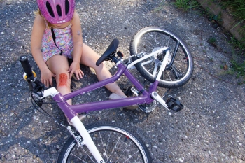 Wundmoulage Schürfwunde