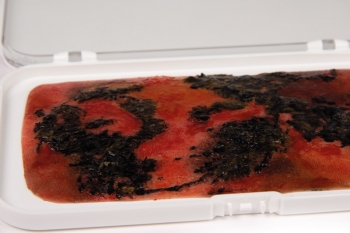 Wundmoulage Brandwunde 3. Grades